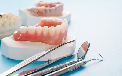 When Should you Consider Complete Dentures?