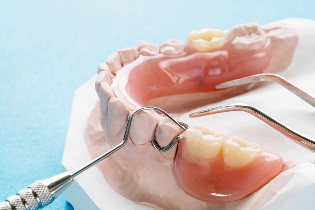 temporary partial denture temporary partial denture