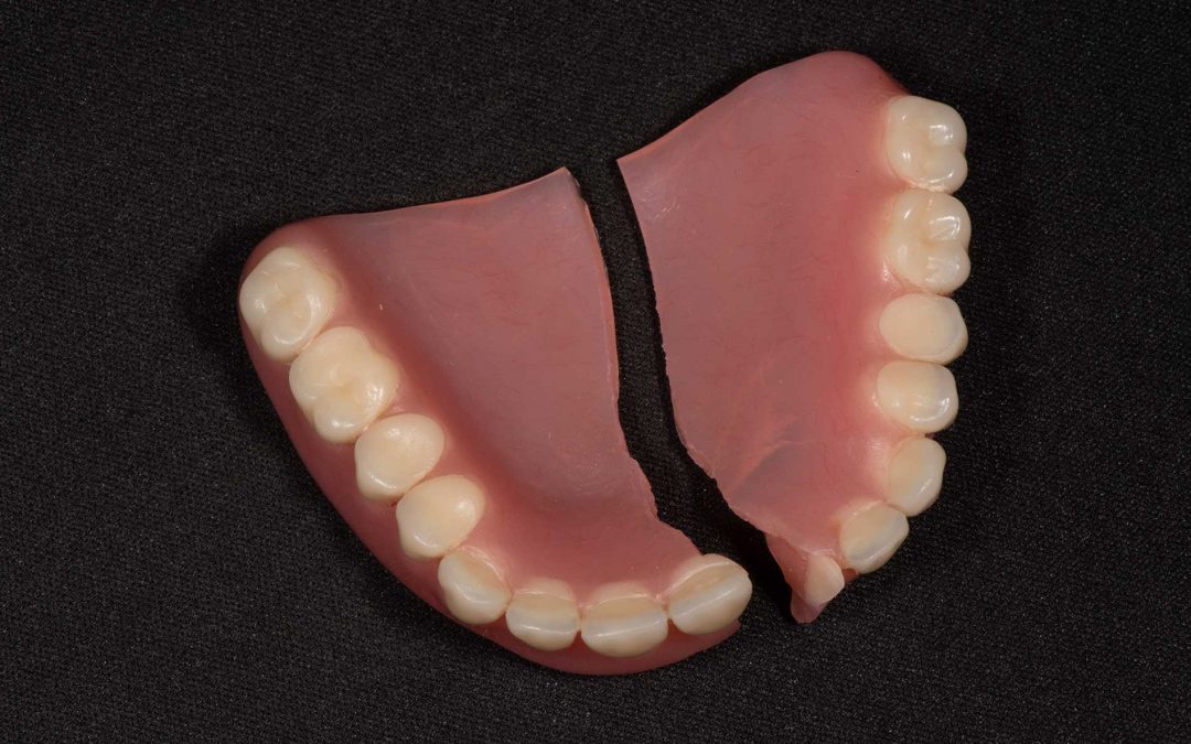 What Causes Broken Dentures