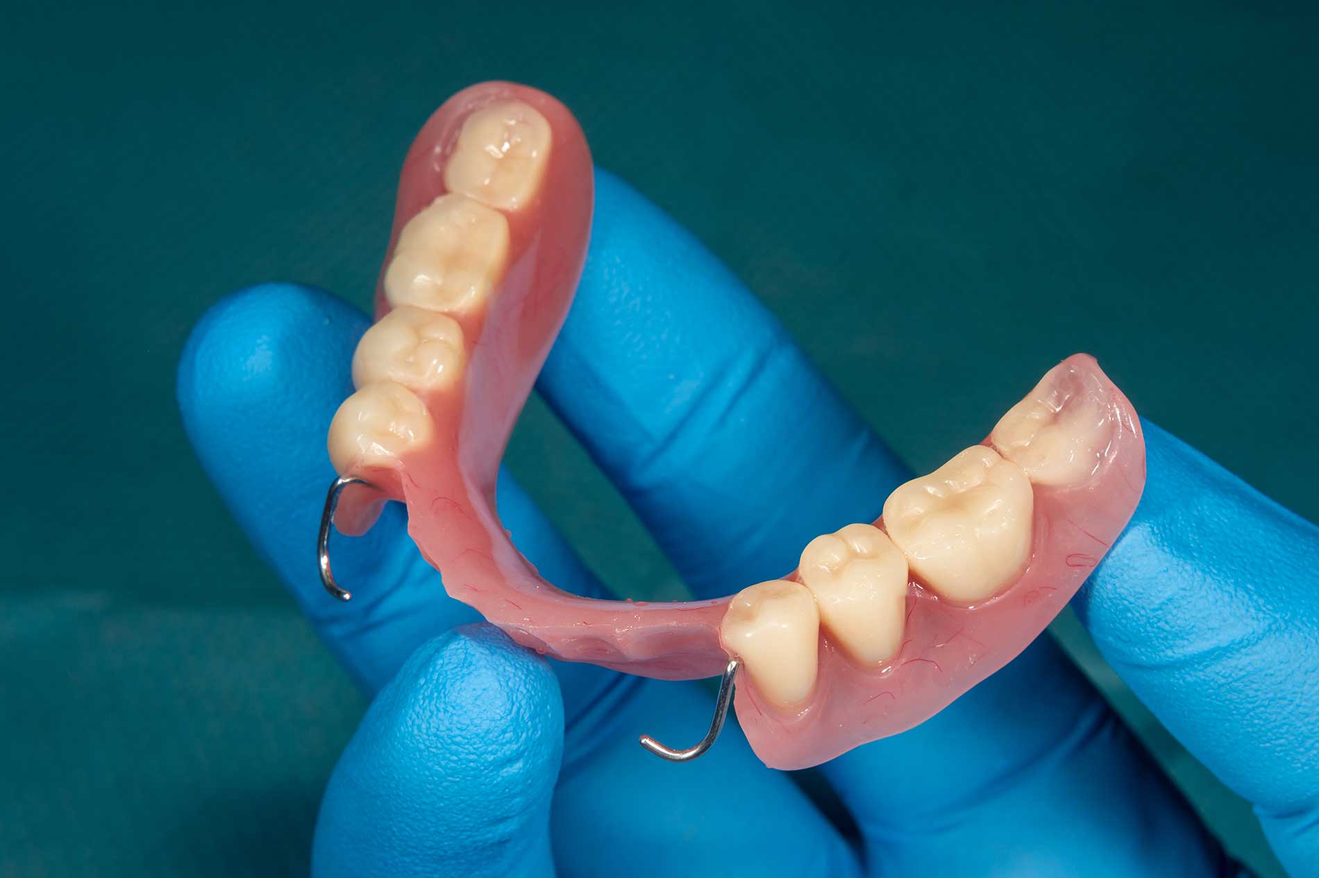 Features-of-Complete-Dentures Features-of-Complete-Dentures